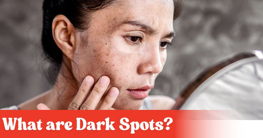 What Are Dark Spots